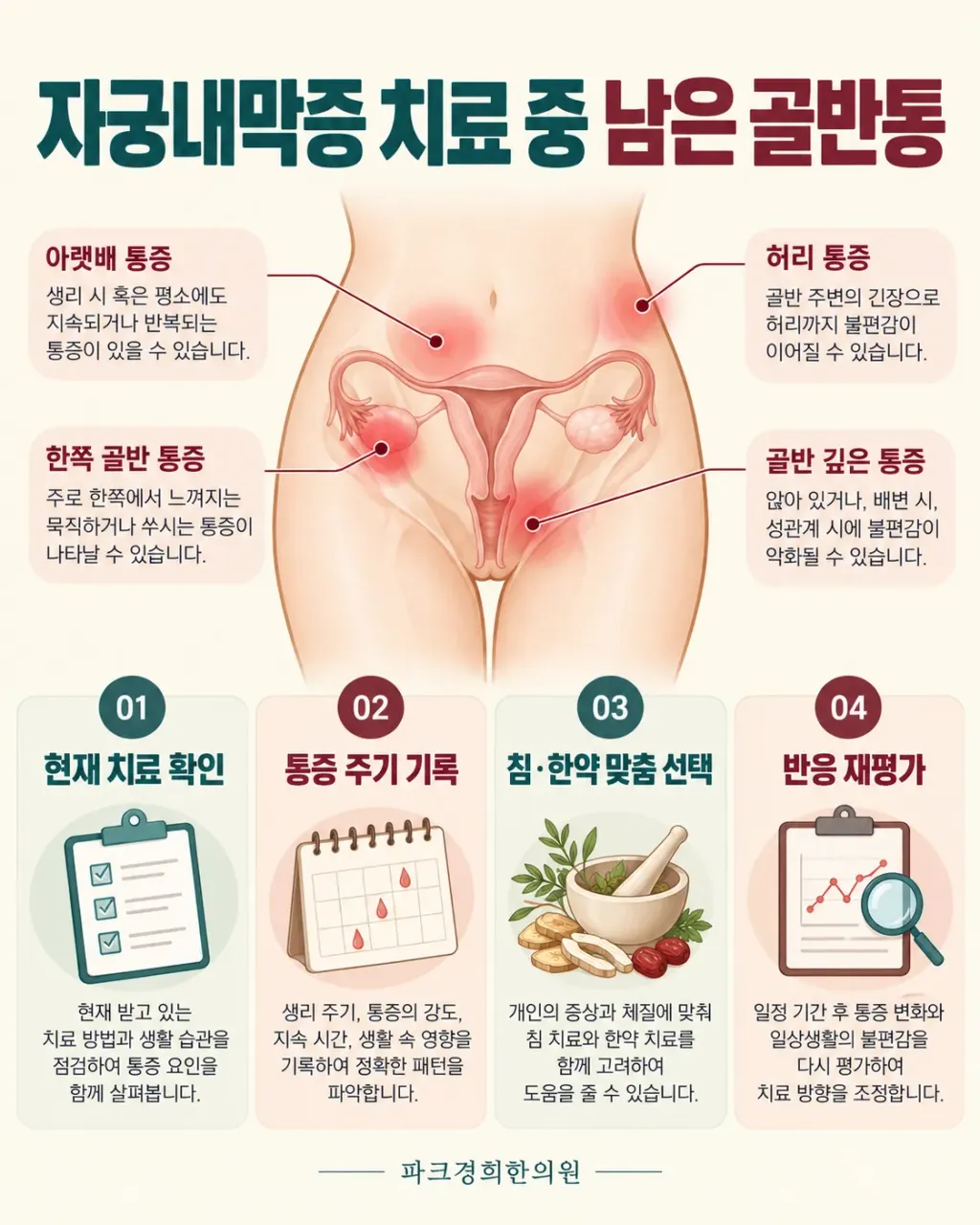 춘천 산부인과 추천 받고 자궁내막증 호르몬 치료받던 중, 파크경희한의원 침·한약 치료로 남은 골반통과 수면을 관리하려면 (2).webp