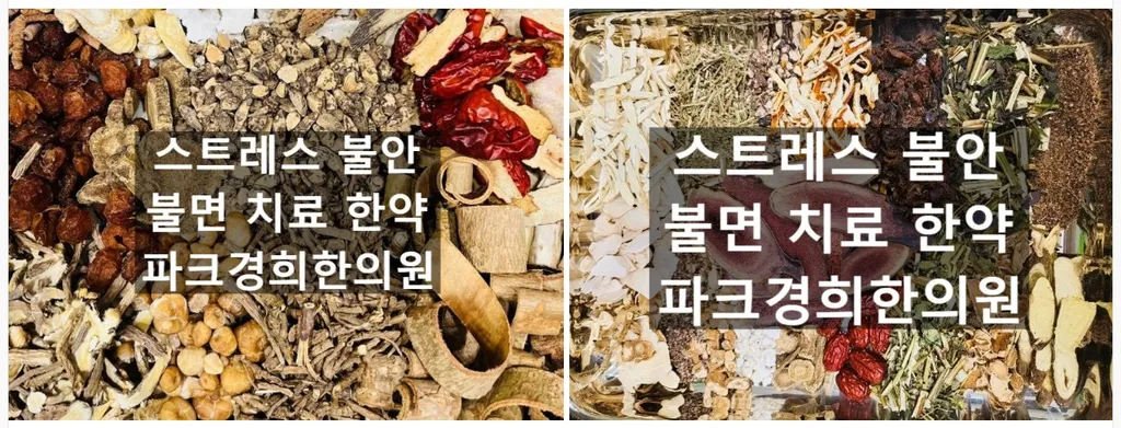 춘천정신건강의학과에서 하지불안증후군을 진단받았다면, 춘천명동한의원에서 병행치료를.jpg