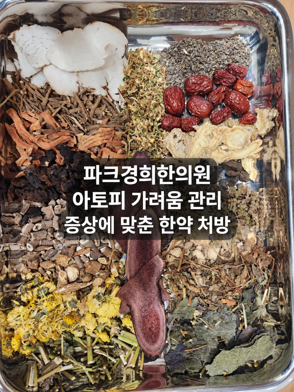 2026-09-29_춘천_아토피_야간가려움_파크경희한의원_한약_01_ 2.png