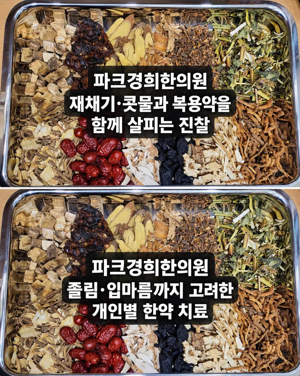 춘천 알레르기비염약 졸림·입마름, 파크경희한의원의 침·약침·한약 치료 선택 6.png