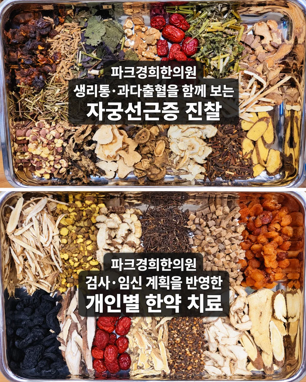 춘천 자궁선근증 생리통·과다출혈, 파크경희한의원의 침·약침·한약 치료 방향 5.png