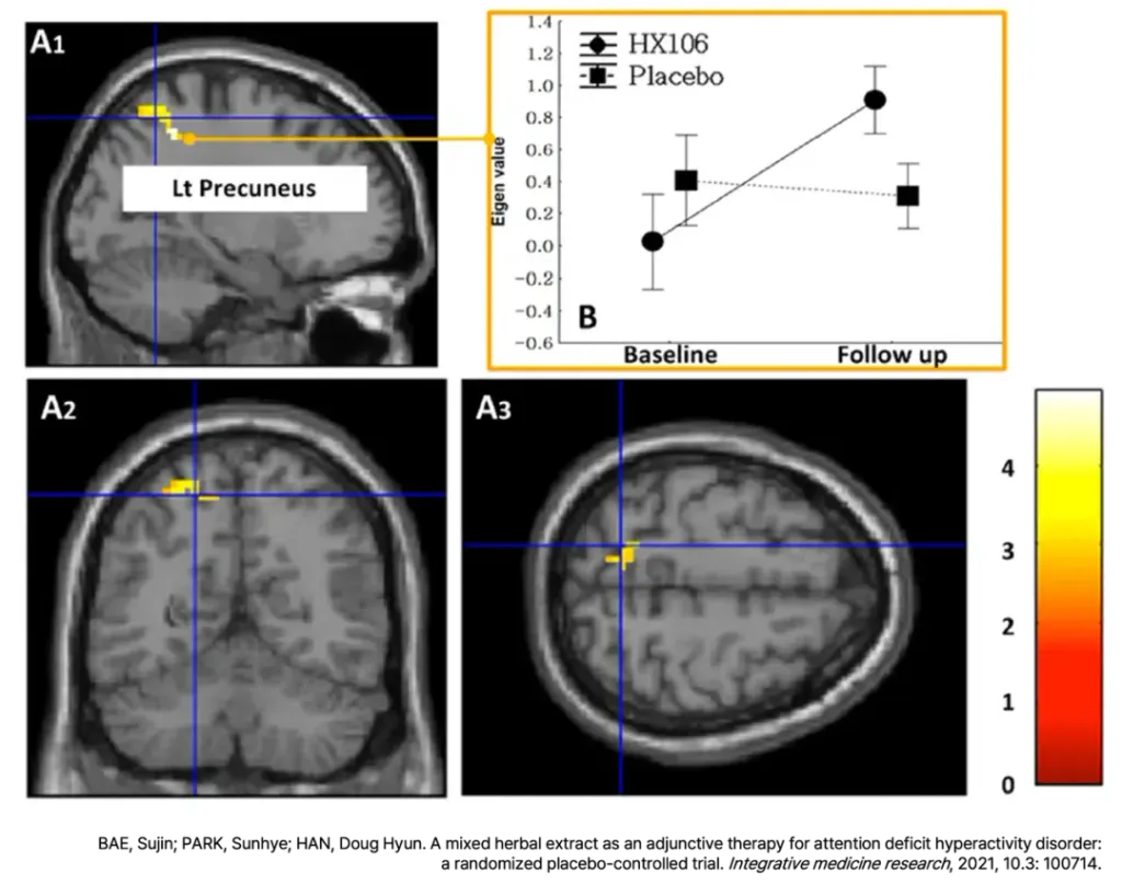 fmri.webp