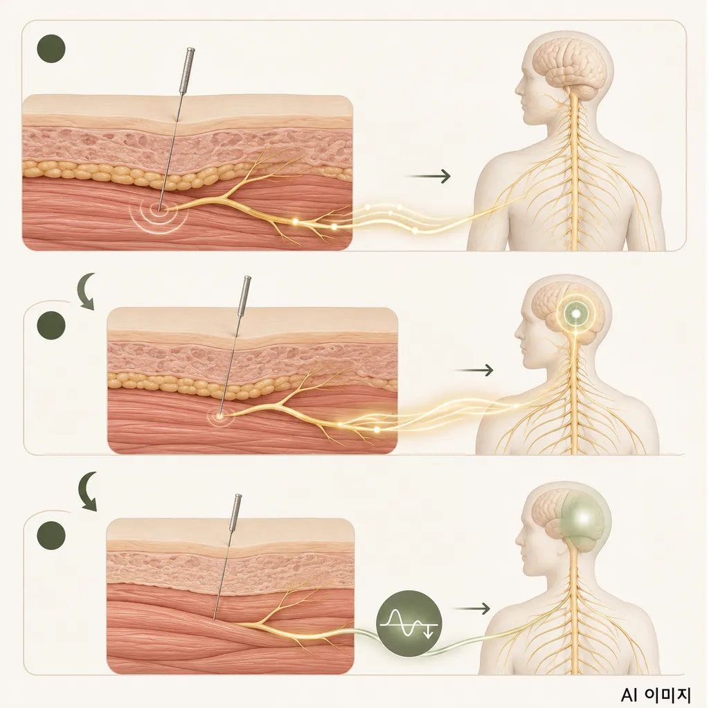 acupuncture-pain-control-mechanism.png