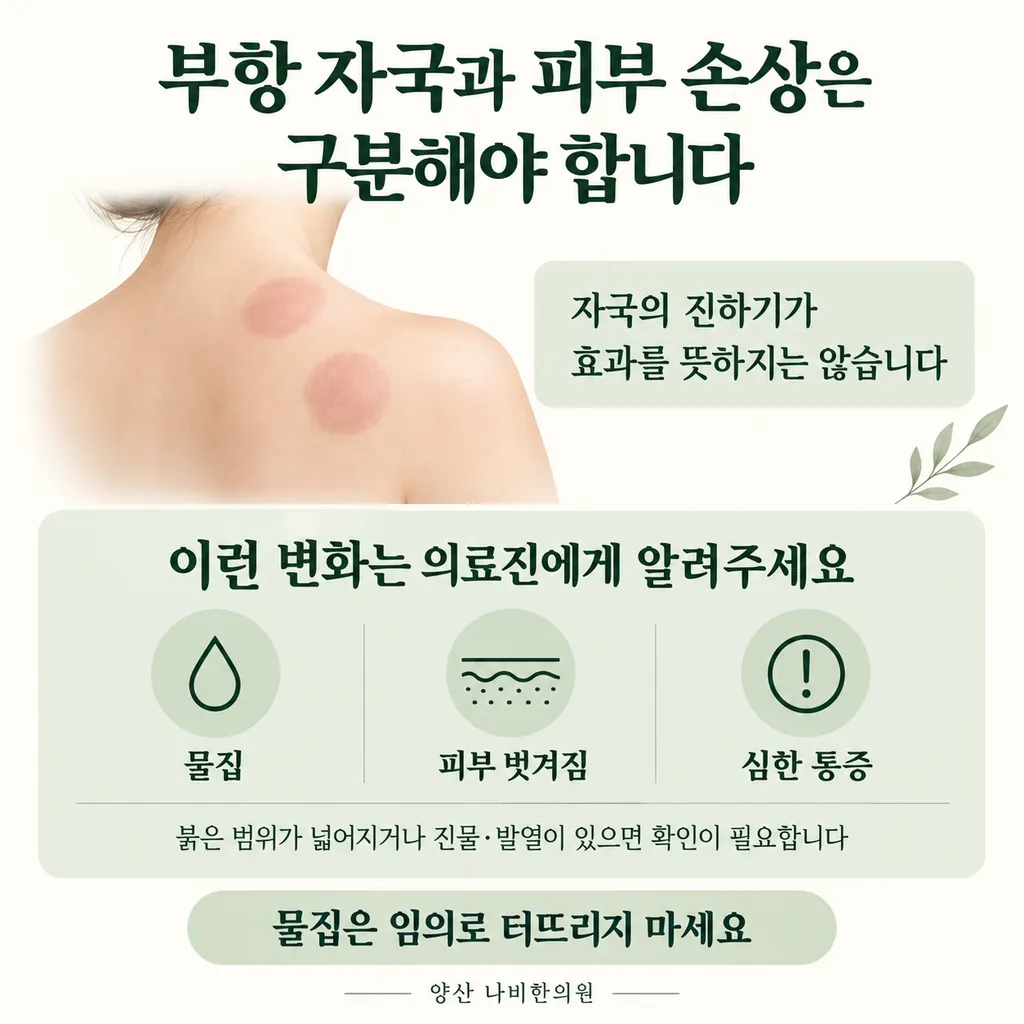 cupping-marks-skin-precautions.png