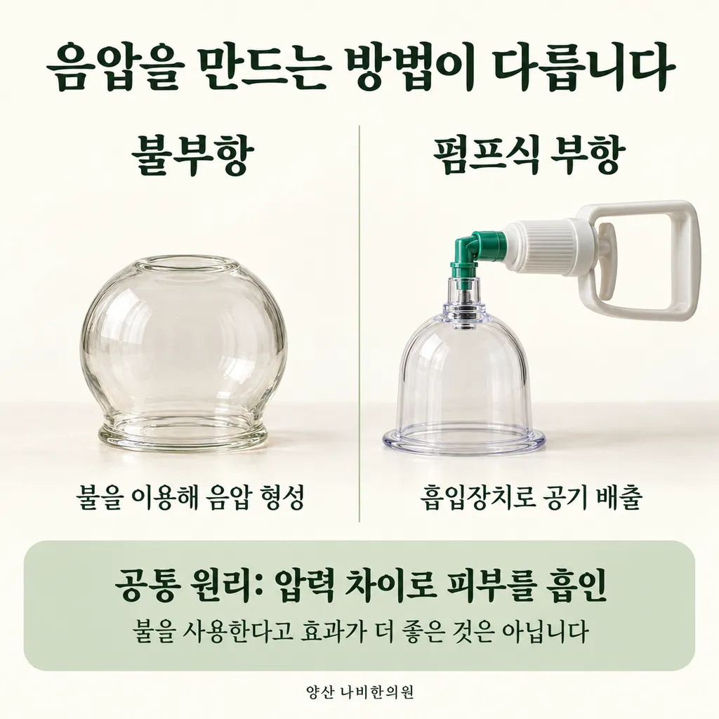 fire-vs-pump-cupping.png