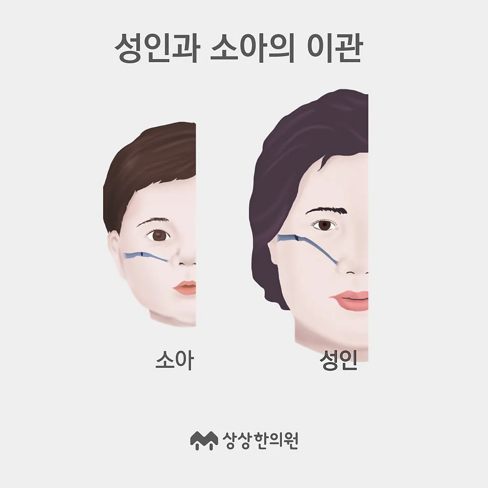 형개연교탕 - 피부염증, 중이염, 비염에 효과적인 형개연교탕 이야기