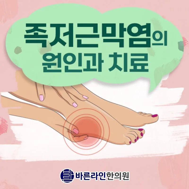 족저근막염 통증으로 화끈한 발바닥, 야탑 야탑역 약침치료 바른라인한의원