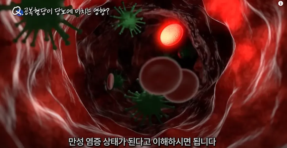 혈당건강 지키기 (3) - 내 공복혈당이 높은 이유. 공복혈당 낮추는 가장 확실한 방법