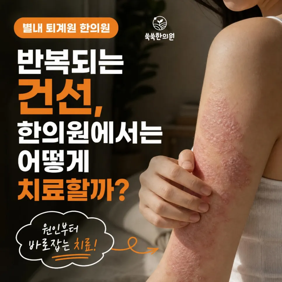 별내 건선 한의원, 건선은 왜 반복될까요? 원인부터 치료까지