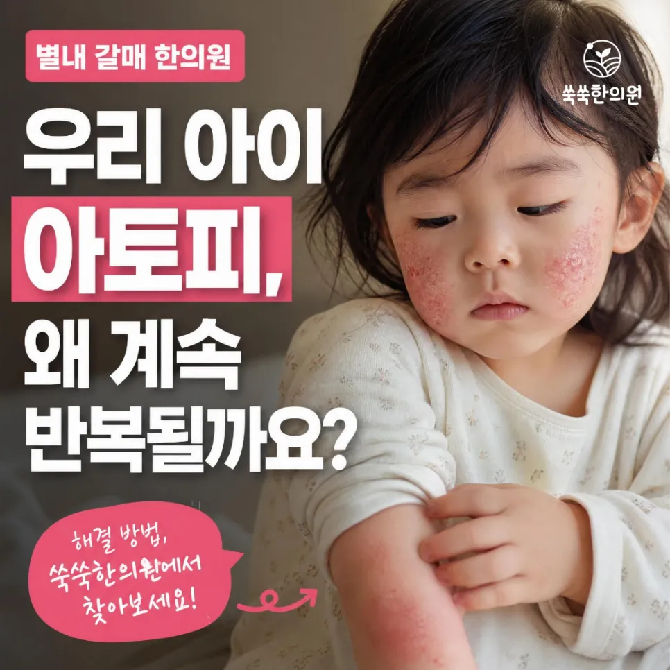 갈매 별내 소아 아토피 치료, 반복되는 아토피피부염 원인부터 한의원 치료까지