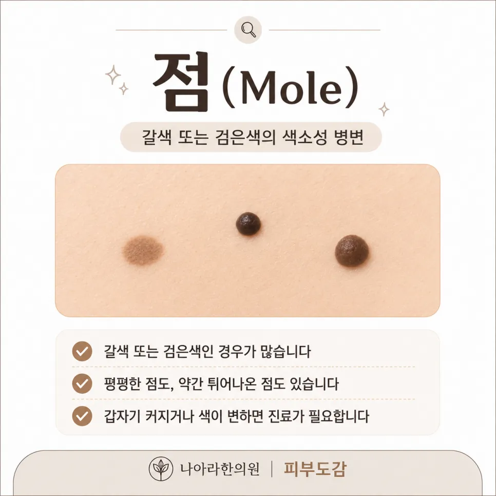 얼굴에 생기는 오돌토돌한 것, 다 점이 아닙니다