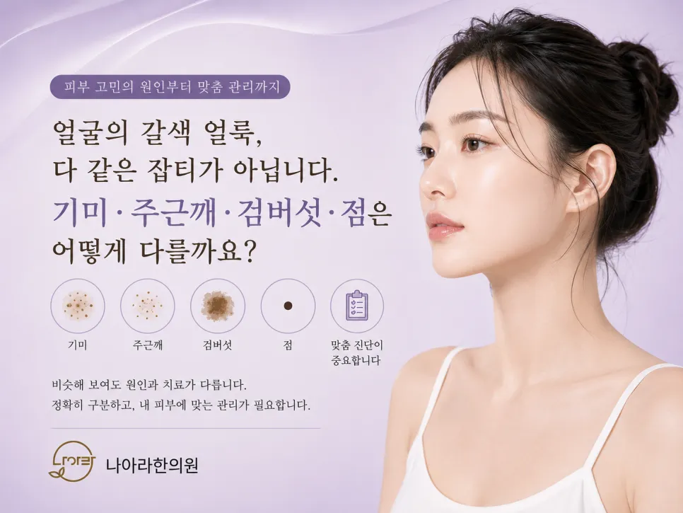 얼굴의 갈색 얼룩, 다 같은 잡티가 아닙니다
기미·주근깨·검버섯·점은 어떻게 다를까요?