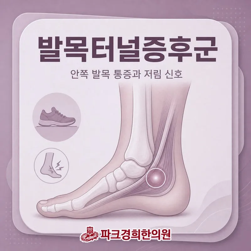 발목터널증후군 족근관의 염증이 신경을 압박 춘천 우두동