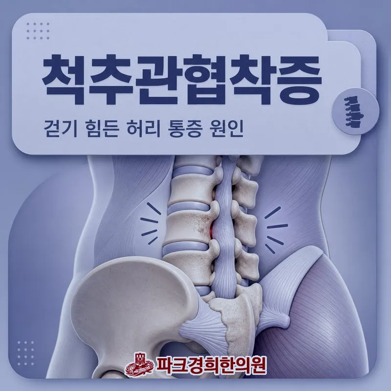 춘천 퇴계동 파크경희한의원 척추관협착증을 야기하는 척추변형의 주요 원인은