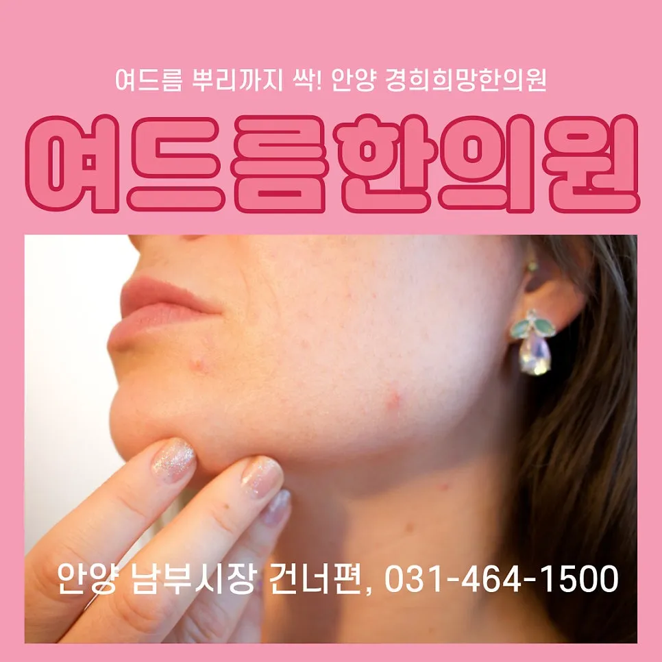 [한방피부과]안양 여드름 한의원 치료 효과, 가격 안내
