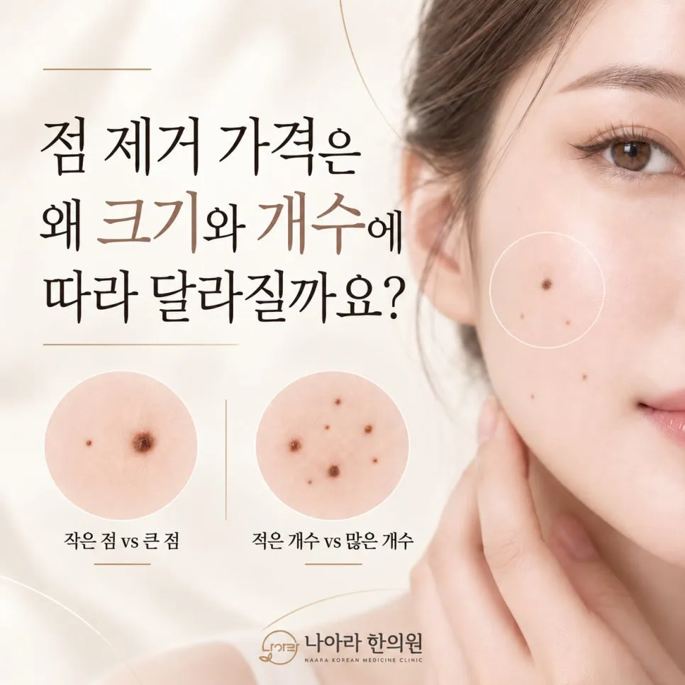 점 제거 가격은 왜 크기와 개수에 따라 달라질까요?