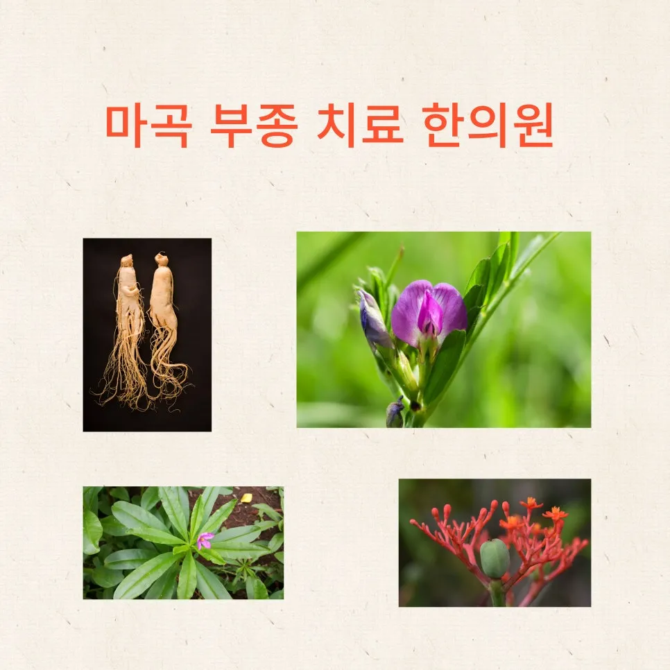 마곡 부종 치료 한약 특발성 부종 기허부종 함요부종