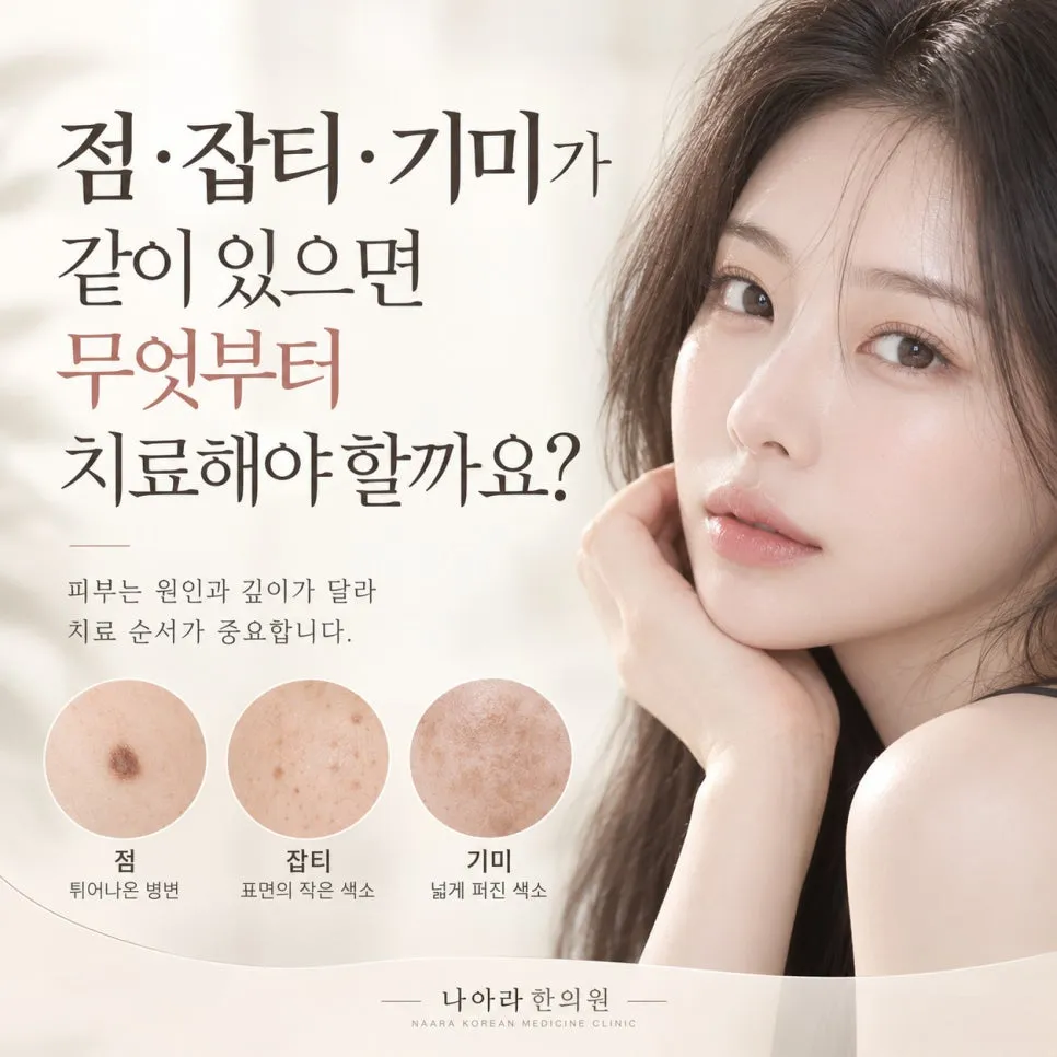 점·잡티·기미가 같이 있으면 무엇부터 치료해야 할까요?