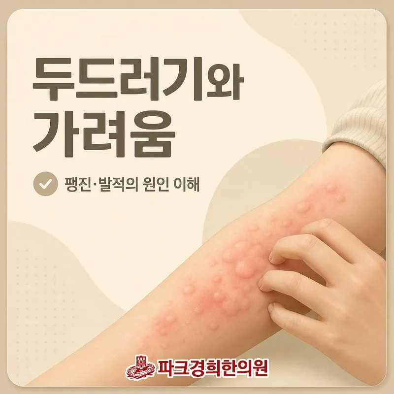 춘천 온의동 피부 두드러기 치료 병원 개선을 넘어 전인적 관리까지