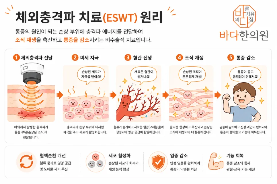 체외 충격파 치료(ESWT) 도입!