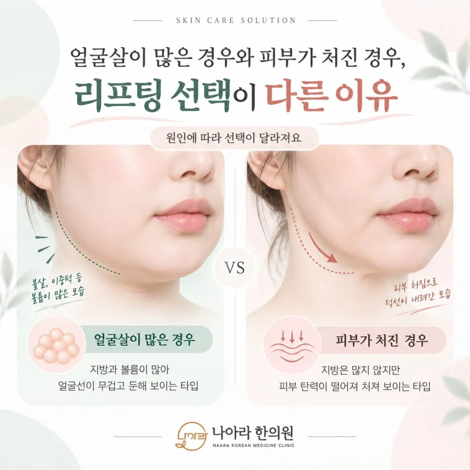 얼굴살이 많은 경우와 피부가 처진 경우, 리프팅 선택이 다른 이유