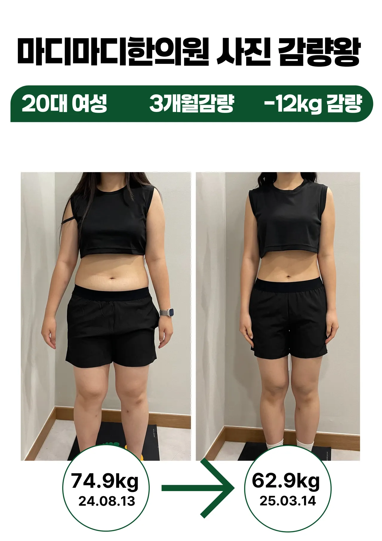갤러리 이미지