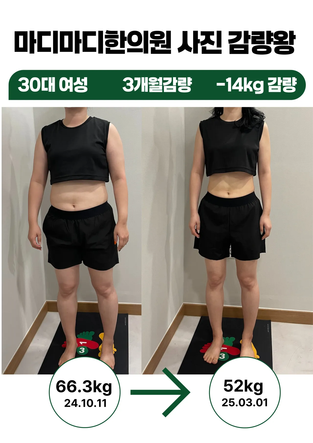 갤러리 이미지