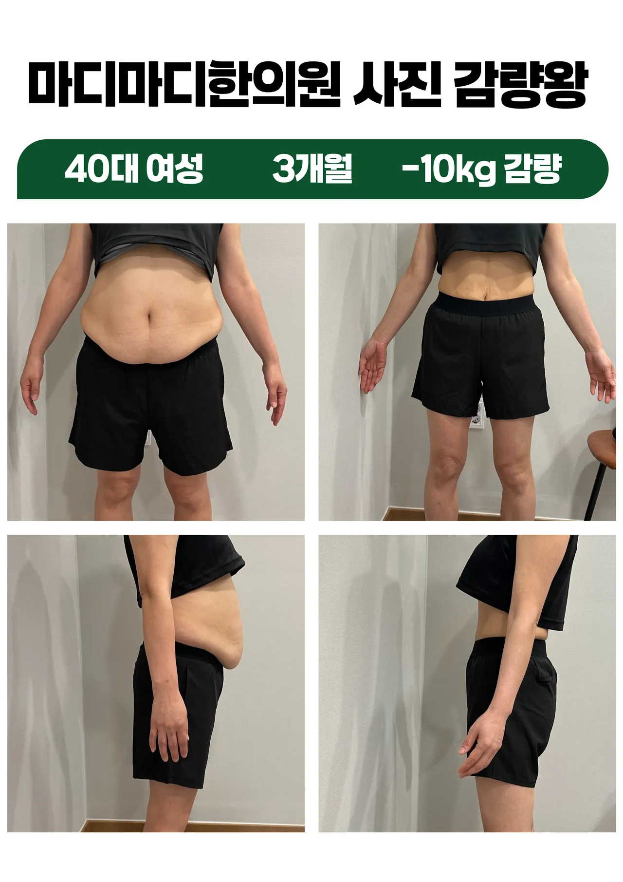 갤러리 이미지