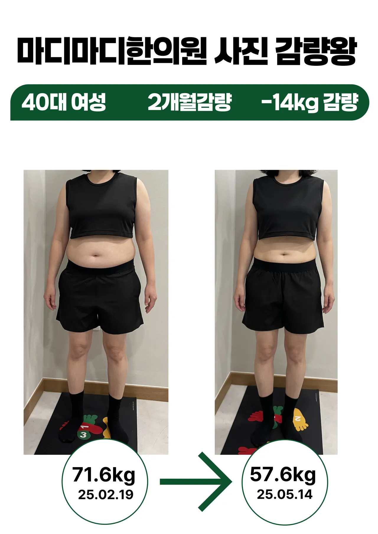 갤러리 이미지