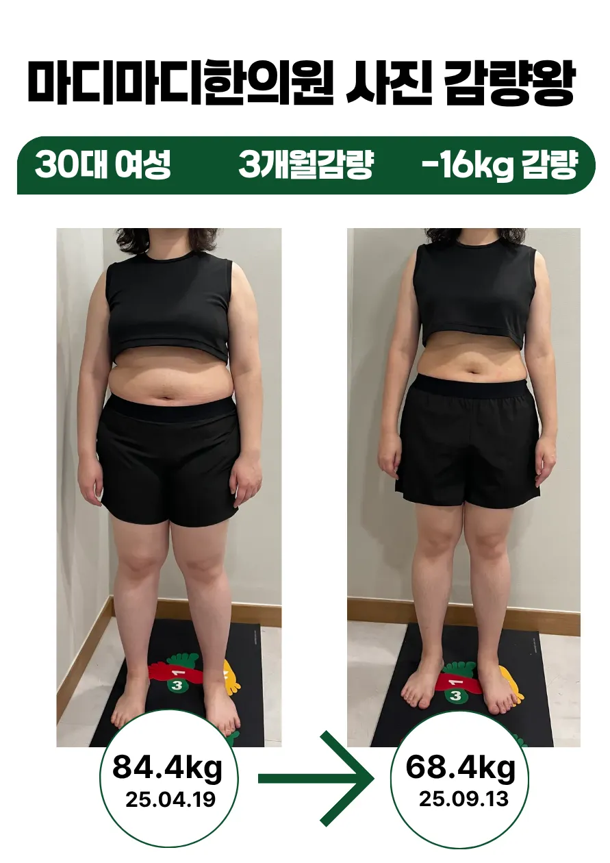 갤러리 이미지