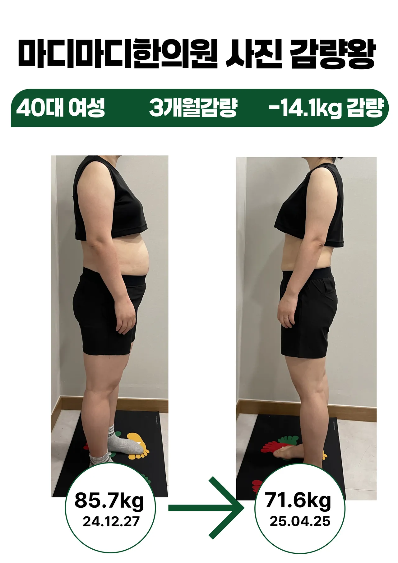 갤러리 이미지