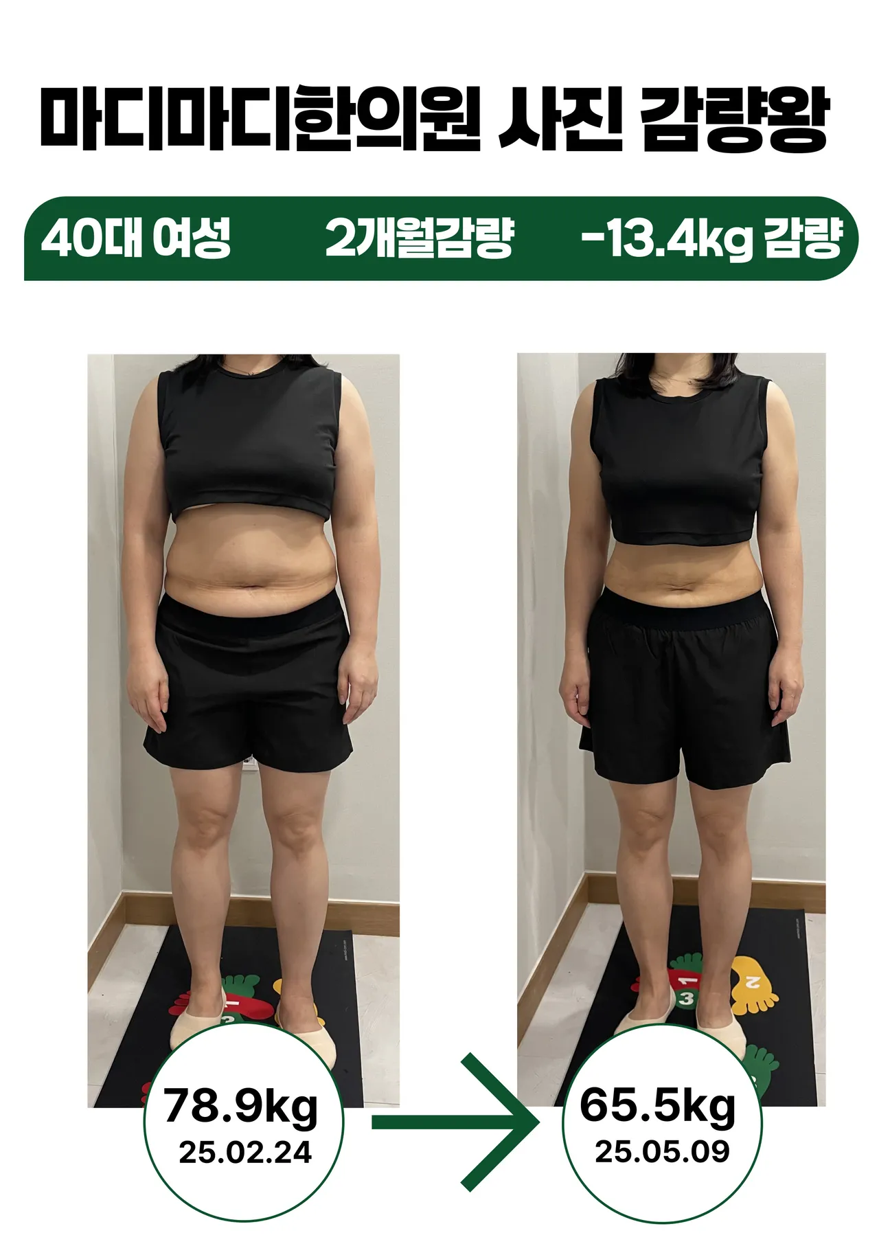 갤러리 이미지