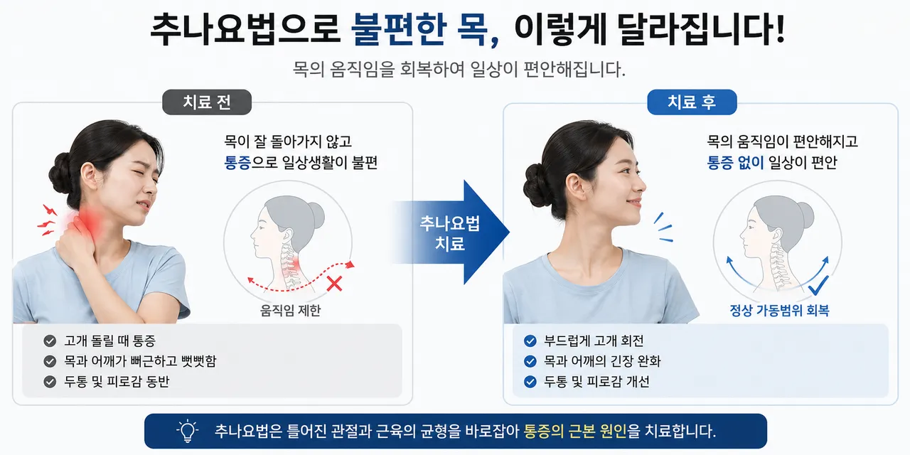 추나요법 경추 효과.png