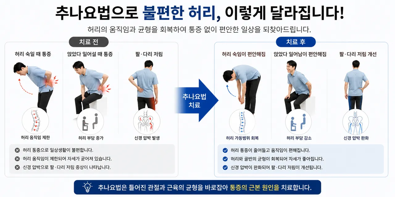 추나요법 요추 효과.png