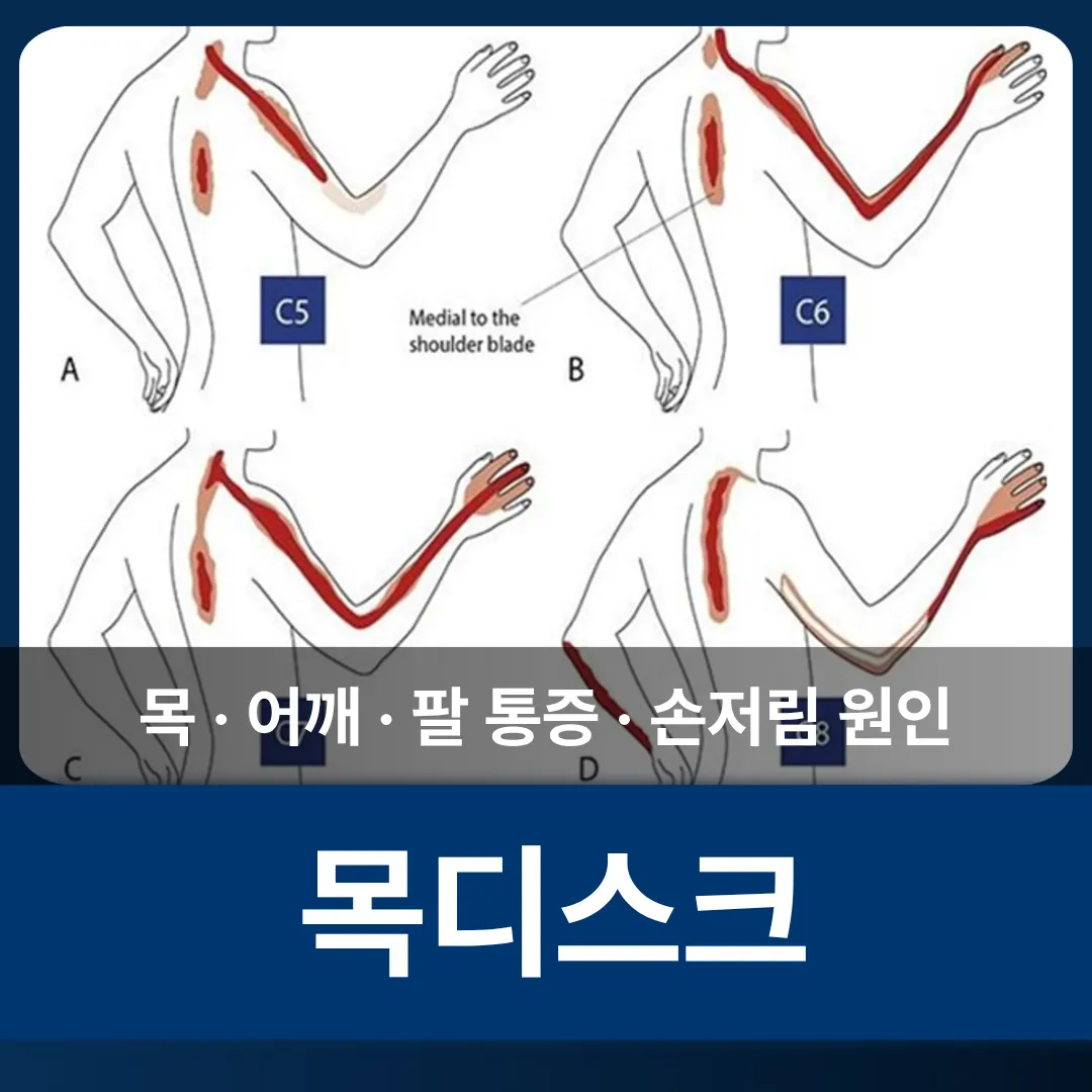 목_하부경추_썸네일.png