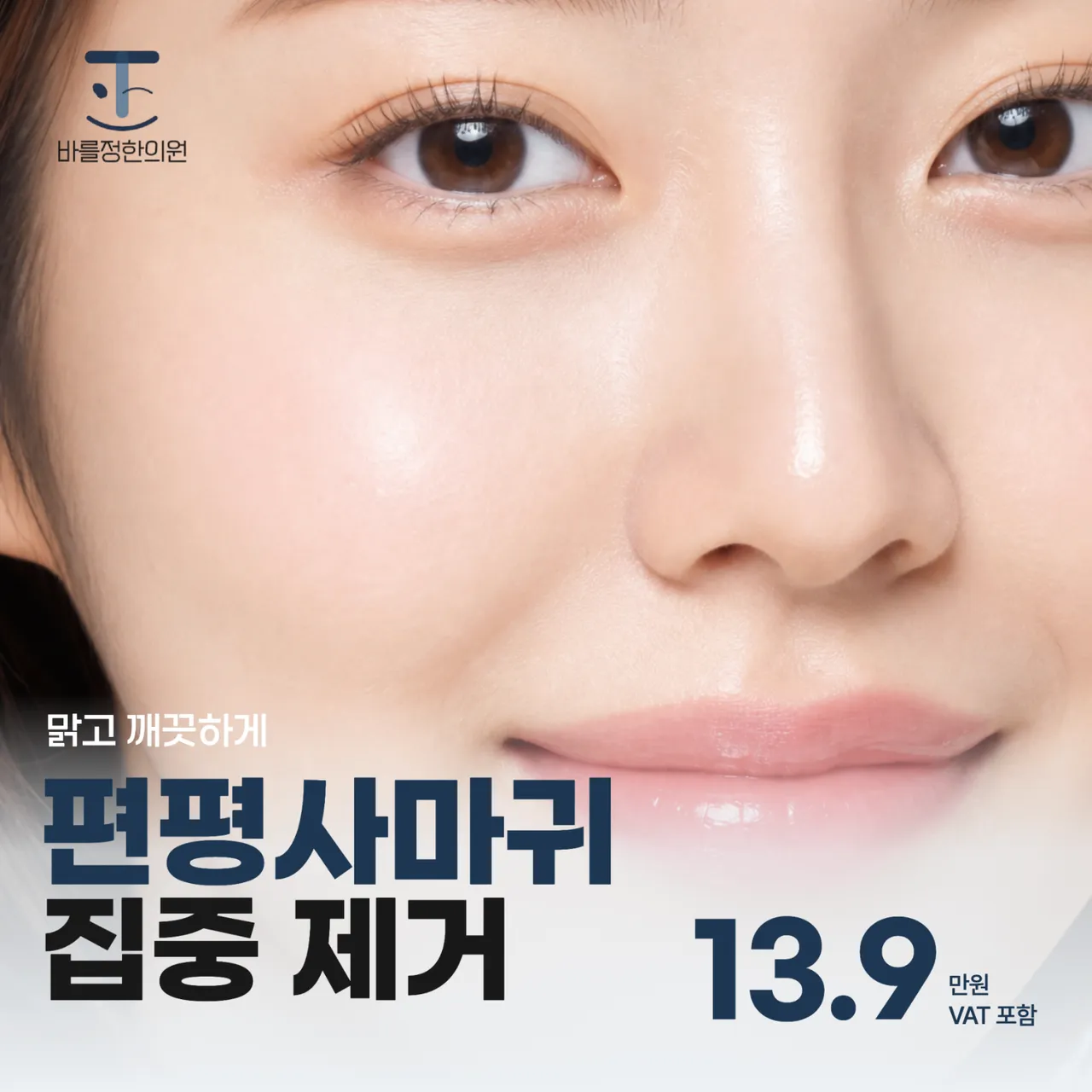 바를정한의원_편평사마귀  무제한 제거-썸네일.png