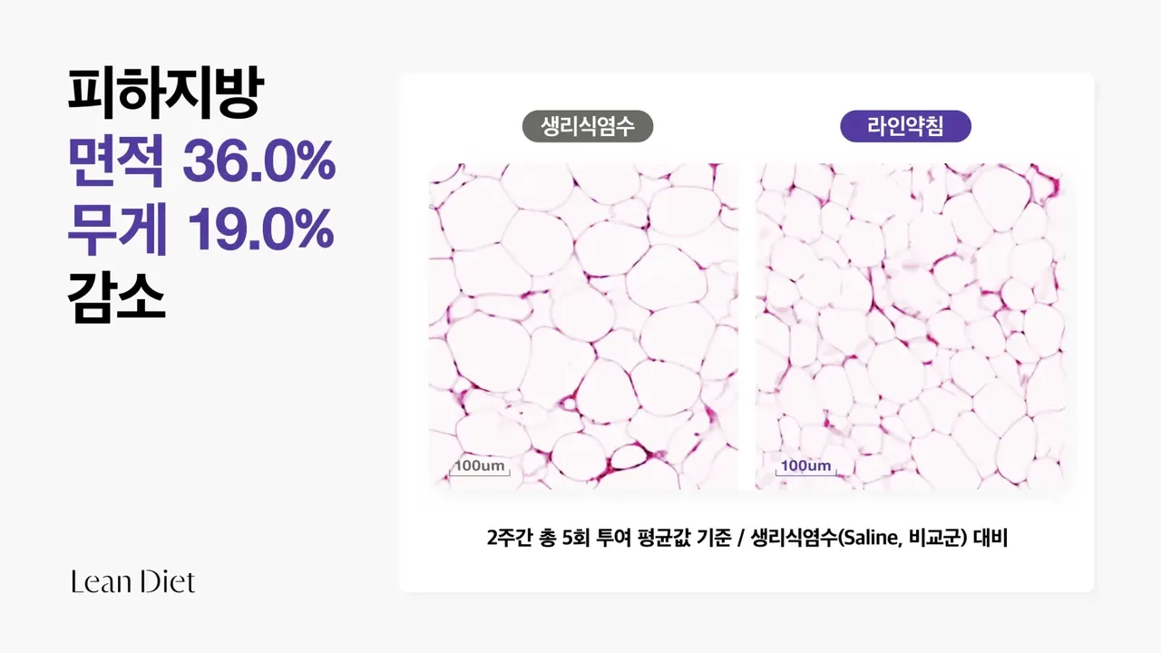 지방분해 약침.jpg