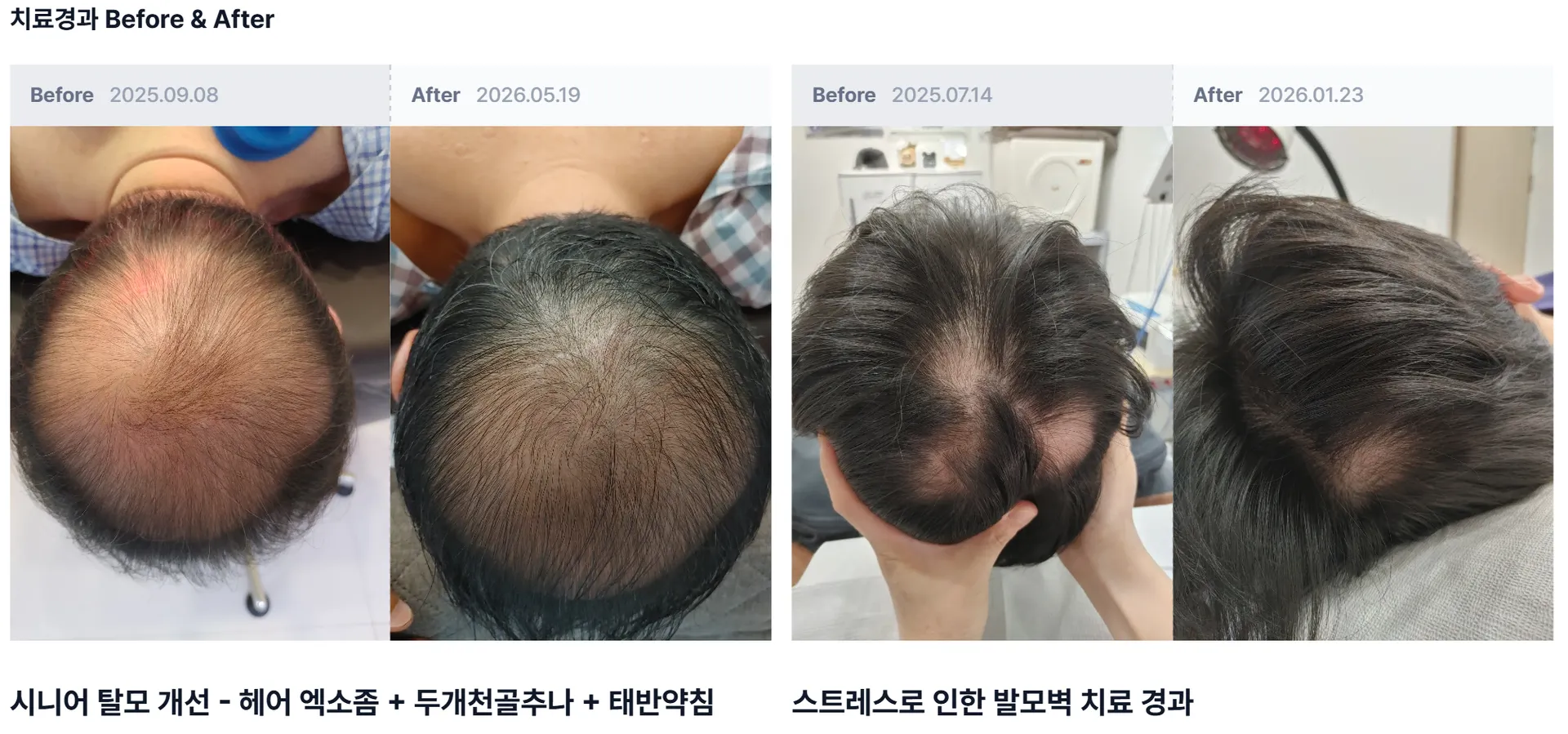 홈페이지게시사례.png
