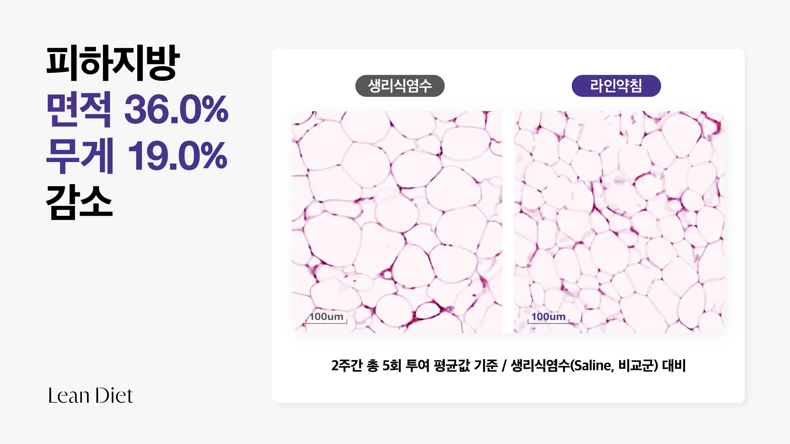 아큐렉스_라인_사이니지_가로4.jpg